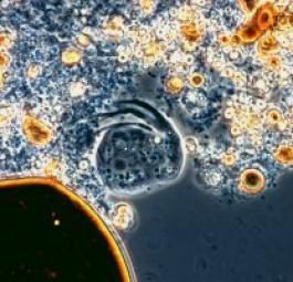 Познакомьтесь с микробами поедающими нефть в Мексиканском заливе!