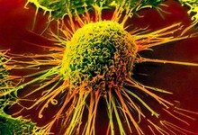 Ученые установили, что раковые клетки используют для размножения фруктозу
