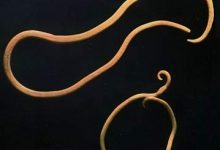 На эволюцию человека повлияли паразитические черви